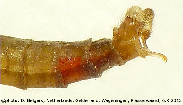 body part(s) - abdomen