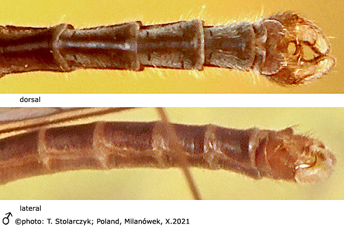 body part(s) - abdomen