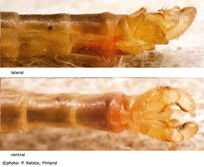 body part(s) - abdomen