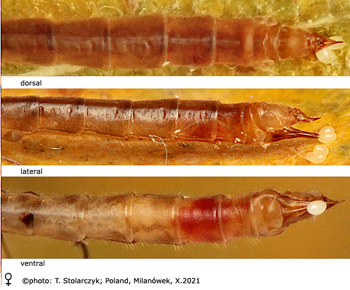 body part(s) - abdomen