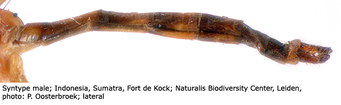 body part(s) - abdomen