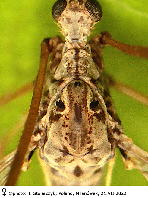 body part(s) - thorax