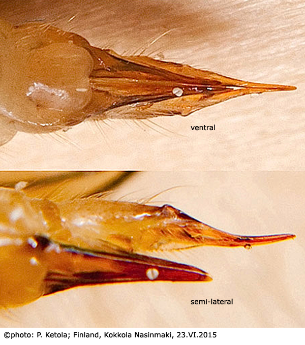 ovipositor