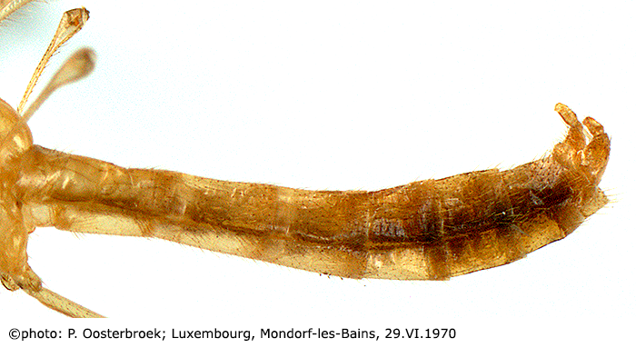 body part(s) - abdomen