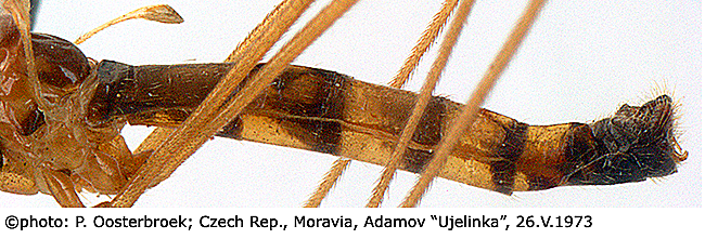 body part(s) - abdomen