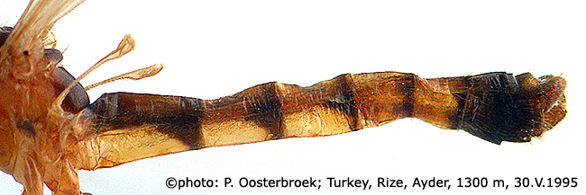 body part(s) - abdomen