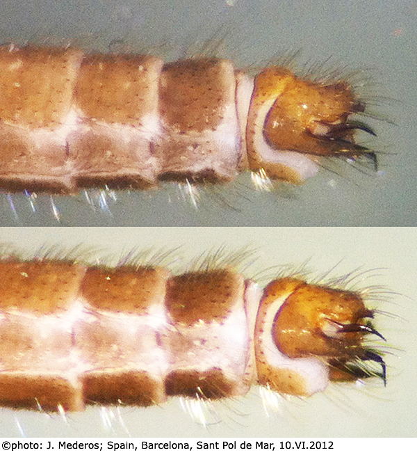 body part(s) - abdomen