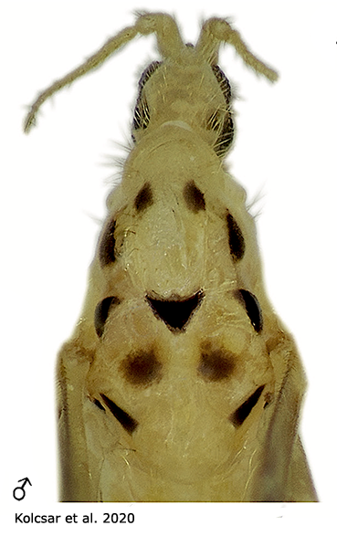 body part(s) - thorax