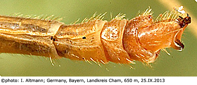 body part(s) - abdomen