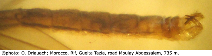 body part(s) - abdomen