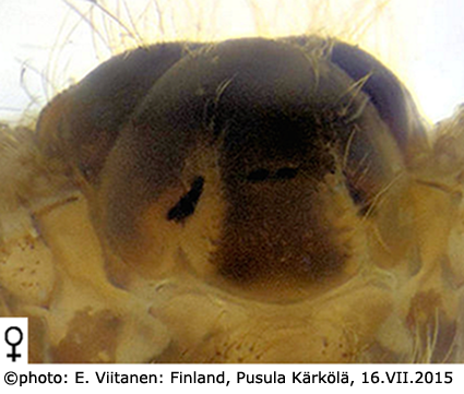 body part(s) - thorax