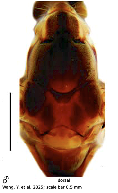 body part(s) - thorax