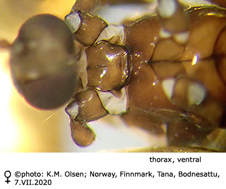 body part(s) - thorax