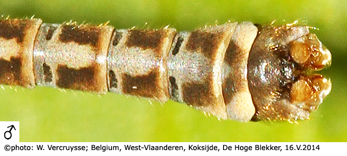 body part(s) - abdomen