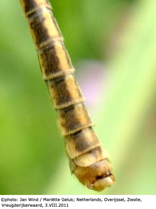 body part(s) - abdomen