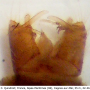 Cheilotrichia (Empeda) fuscohalterata : hypopygium