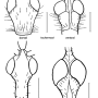 Dactylolabis (Dactylolabis) carbonaria : body part(s) - head