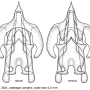 Dactylolabis (Dactylolabis) wudangensis : hypopygium
