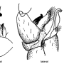 Dicranomyia (Glochina) kinensis : hypopygium