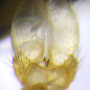 Dicranomyia (Dicranomyia) radegasti : hypopygium