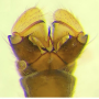 Dicranomyia (Glochina) tristis : hypopygium