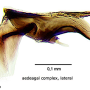 Dicranophragma (Brachylimnophila) separatum : hypopygium