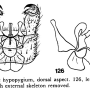 Dicranoptycha laevis : hypopygium