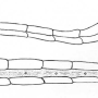 Dicranoptycha megaphallus : body part(s) - abdomen