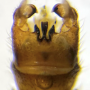 Dolichopeza (Nesopeza) albitibia : hypopygium