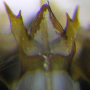 Dolichopeza (Dolichopeza) bifida : hypopygium