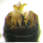 Dolichopeza (Dolichopeza) bifida : hypopygium