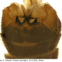 Dolichopeza (Dolichopeza) bifida : hypopygium