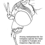 Dolichopeza (Dolichopeza) fuscipes : body part(s) - head