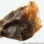 Dolichopeza (Dolichopeza) nitida : hypopygium