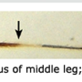 Elephantomyia (Elephantomyodes) angusticellula : body part(s) - leg