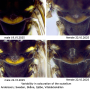 Ellipteroides (Ellipteroides) lateralis : body part(s) - head and thorax