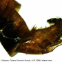 Metalimnobia (Metalimnobia) bifasciata : hypopygium