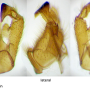 Metalimnobia (Metalimnobia) bifasciata : hypopygium