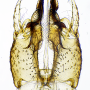 Molophilus (Molophilus) griseus : hypopygium Molophilus (Molophilus) griseus : hypopygium