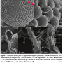 Nipponomyia trispinosa : body part(s) - head