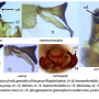 Rhypholophus varius : hypopygium
