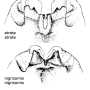 Tanyptera (Tanyptera) nigricornis nigricornis: hypopygium