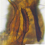 Tasiocera (Dasymolophilus) murina : hypopygium