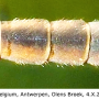 Tipula (Platytipula) melanoceros : body part(s) - abdomen