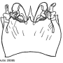 Tipula (Platytipula) melanoceros : hypopygium
