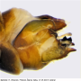 Tipula (Vestiplex) nubeculosa : hypopygium