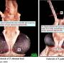 Tipula (Tipula) oleracea : body part(s) - head