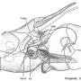 Tipula (Tipula) oleracea : ovipositor