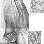 Tipula (Tipula) paludosa : body part(s) - thorax