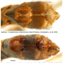 Tipula (Beringotipula) unca : hypopygium